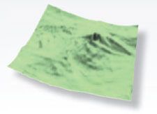 Abbildung - Epiretinale Membran