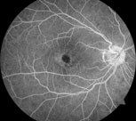 Aufnahme - Digitale FLA