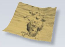 Abbildung - Altersbedingte Makuladegeneration